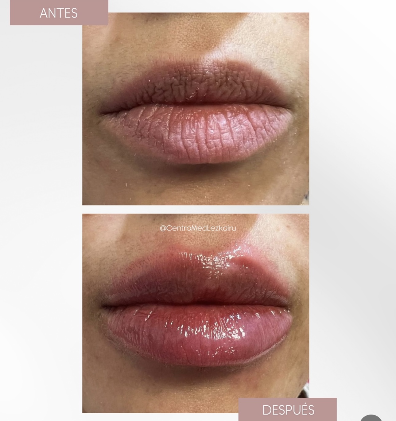 Perfect Lips